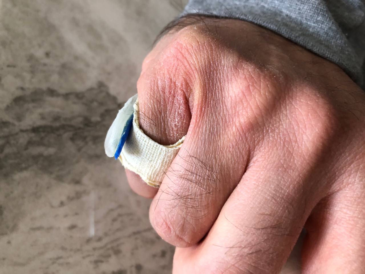 Finger wrapping example